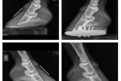 x-rays